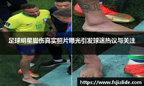 足球明星脚伤真实照片曝光引发球迷热议与关注